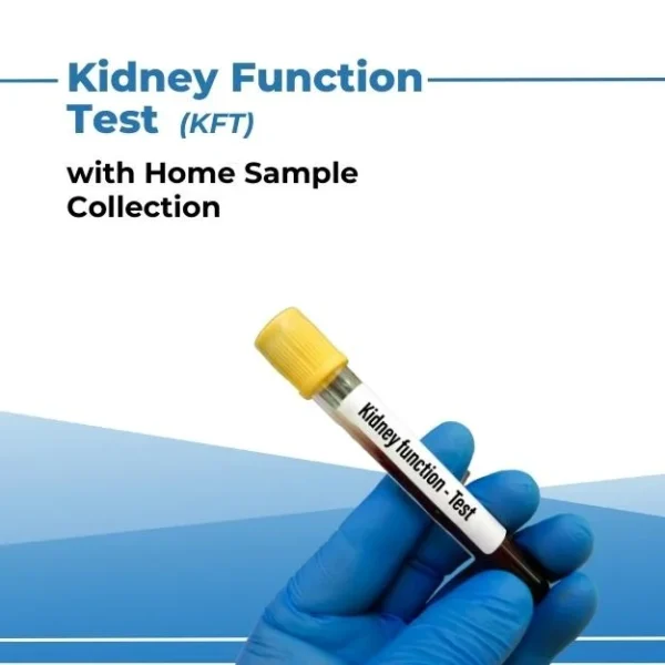 Kidney Function Test (KFT)" https://celebspet.care/